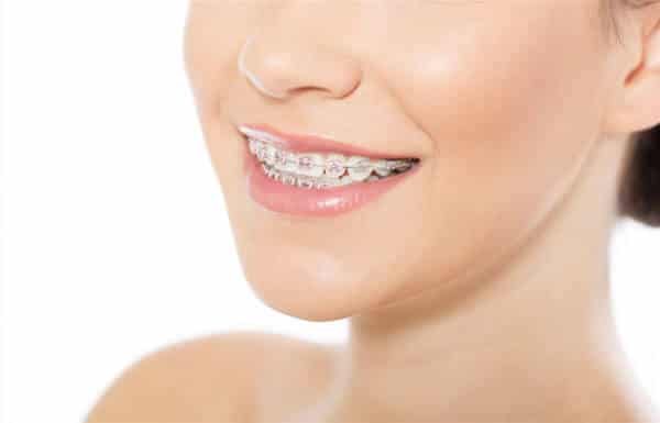 orthodontics-adentaloffice