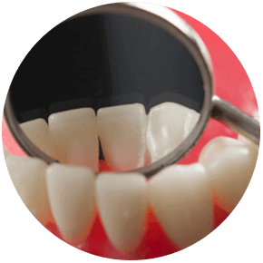 The regular visit to the dental office not only maintain a good oral health and solve a dental problem before it gets bigger but also to avoid you systemic complication like heart and vascular diseases and diabetes.
