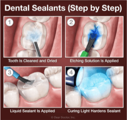 Featured image for: Dentistry is not expensive, neglect is…