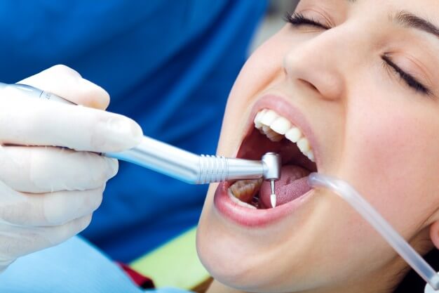 Featured image for: Dental Restorations