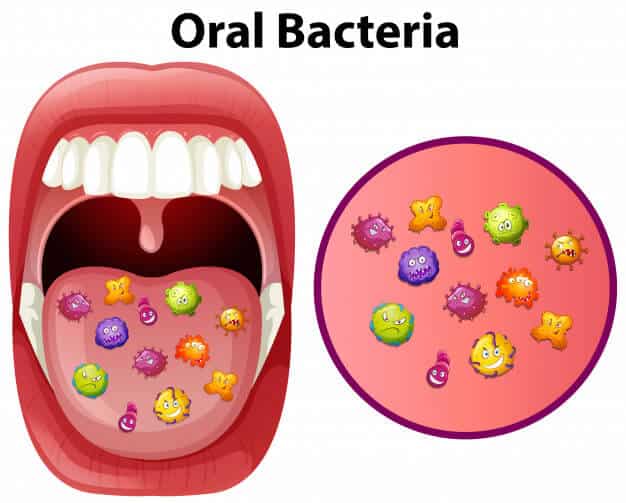 Featured image for: Periodontal Disease