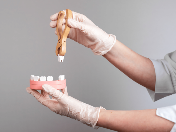 Why Choose Our Dental Clinic for Wisdom Teeth Removal in Barrie