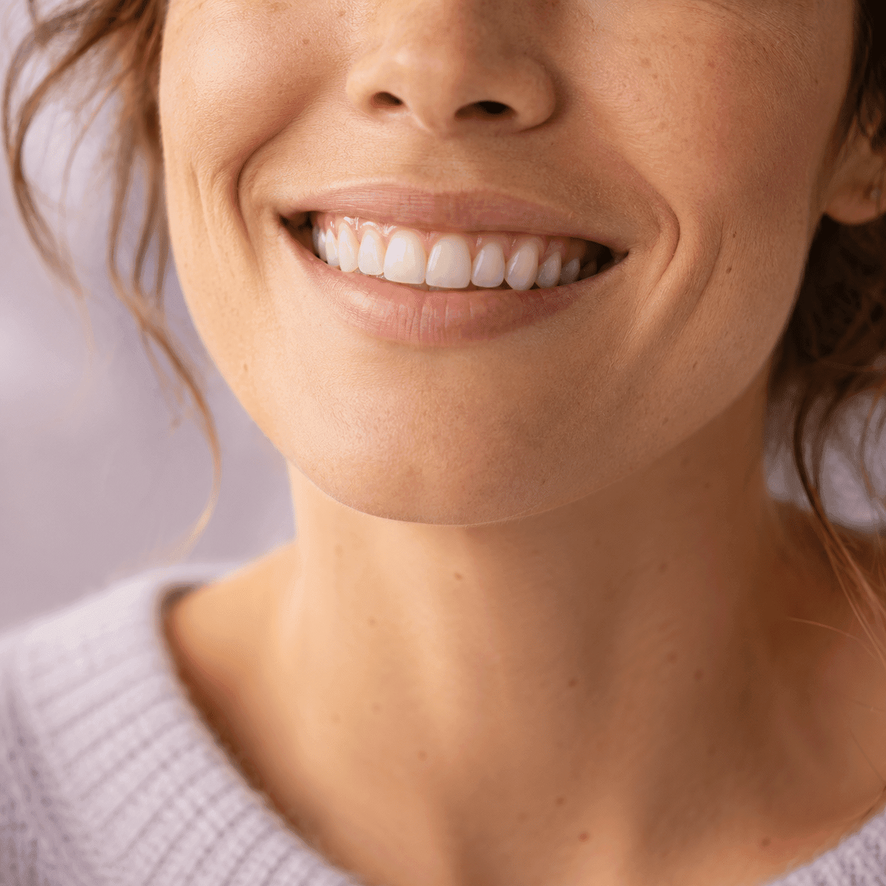 Healthy soft smile and pink gum line after laser periodontal therapy at A Dental Office in Barrie, Ontario