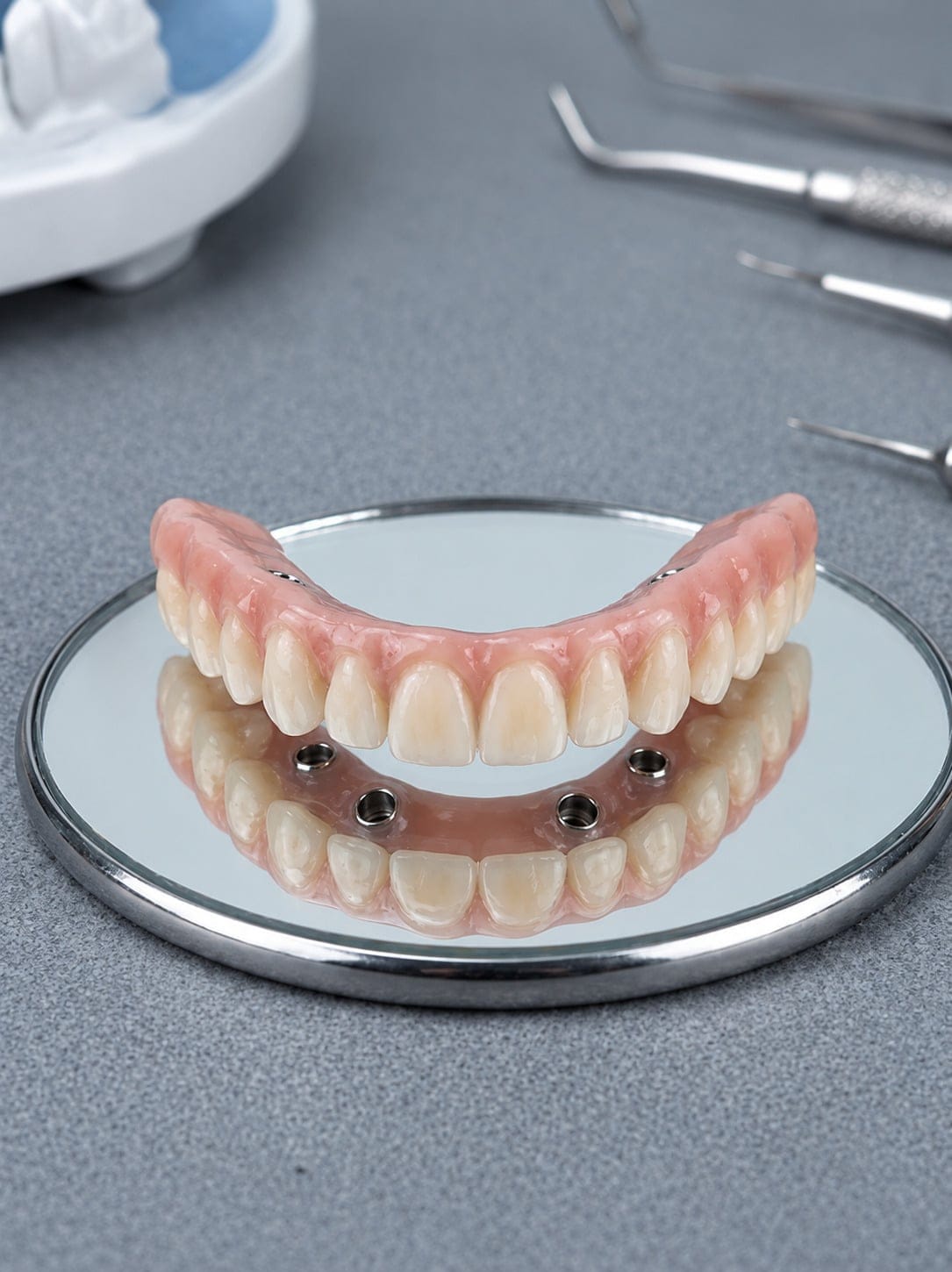 Full-arch dental prosthesis supported by implants for All-On-X treatment at Adental Office in Barrie
